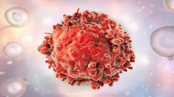 علاج جديد ينقذ المرضى من سرطان الدم الحاد غير القابل للشفاء