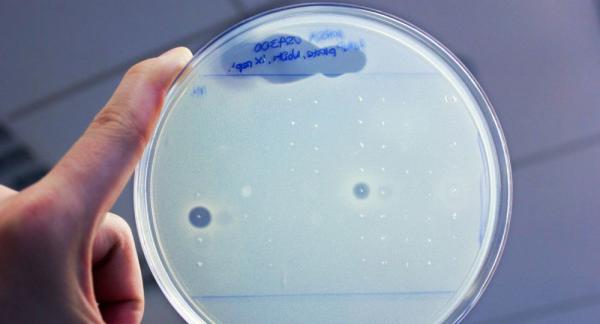 طريقة سريعة ورخيصة لإيجاد مضادات حيوية لأقوى أنواع البكتيريا