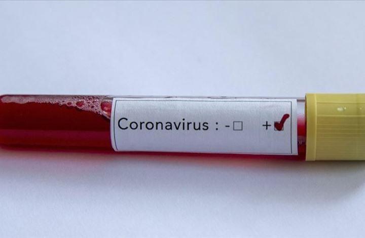 تحذيرات من أدوية مزيفة تباع عبر الإنترنت تدعي علاج كورونا