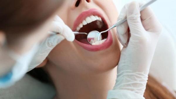 طرق طبيعية لعلاج تسوس الاسنان!