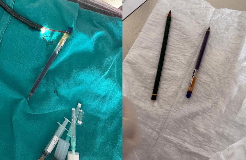 قصة مؤلمة خلف ابتلاع شابة تركية قلمين وإنقاذها بالجراحة