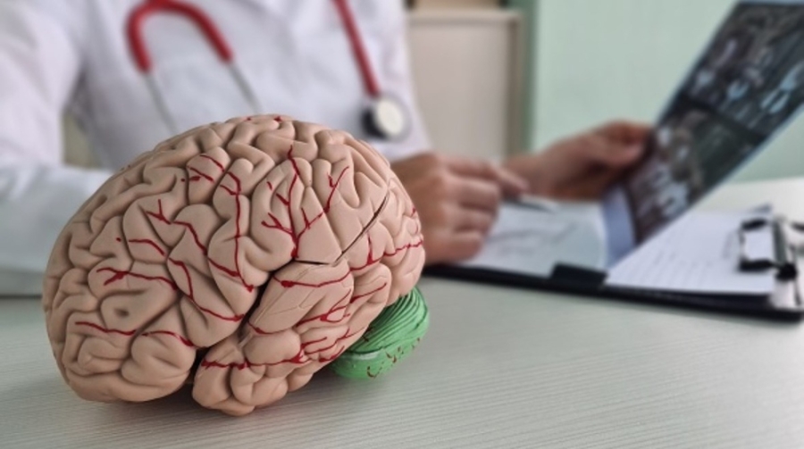 باحثون يطورون كبسولات لعلاج التهاب الدماغ والزهايمر