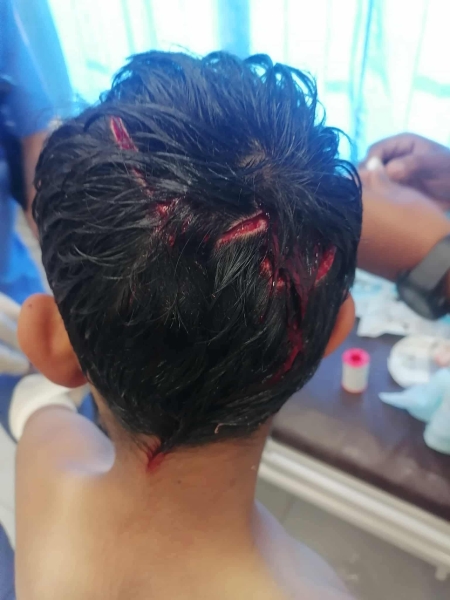 الكلاب الضالة تهاجم طفلاً في لواء بني كنانة أثناء عودته من المدرسة
