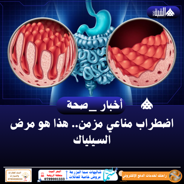اضطراب مناعي مزمن.. هذا هو مرض السيلياك