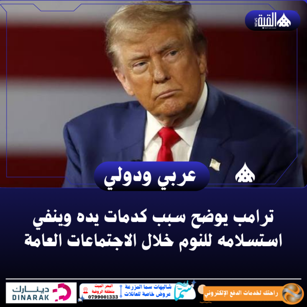 ترامب يوضح سبب كدمات يده وينفي استسلامه للنوم خلال الاجتماعات العامة