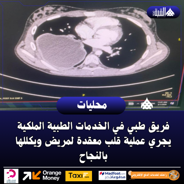 فريق طبي في الخدمات الطبية الملكية يجري عملية قلب معقدة لمريض ويكللها بالنجاح
