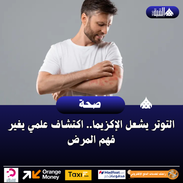 التوتر يشعل الإكزيما.. اكتشاف علمي يغير فهم المرض