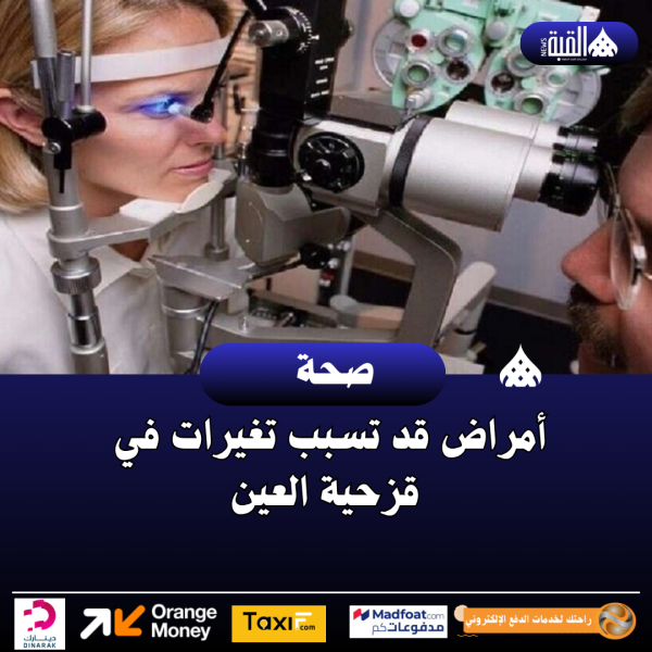 تحذير طبي: تغيّر لون القزحية قد يشير إلى أمراض خطيرة
