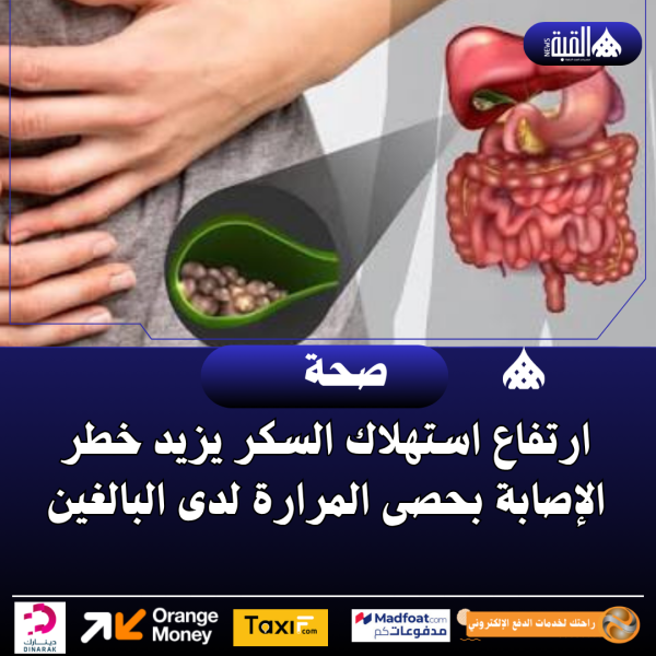 ارتفاع استهلاك السكر يزيد خطر الإصابة بحصى المرارة لدى البالغين