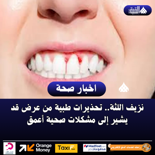 نزيف اللثة.. تحذيرات طبية من عرض قد يشير إلى مشكلات صحية أعمق