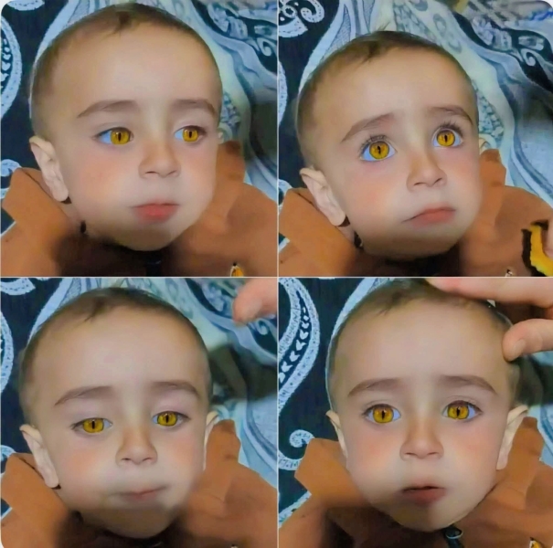 طفل “بعيون نادرة أقرب من ذهب” يشعل الدهشة في ديار بكر التركية