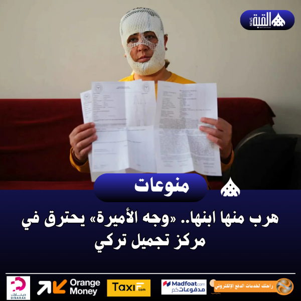 هرب منها ابنها.. «وجه الأميرة» يحترق في مركز تجميل تركي
