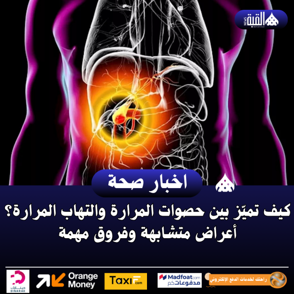 كيف تميّز بين حصوات المرارة والتهاب المرارة؟ أعراض متشابهة وفروق مهمة