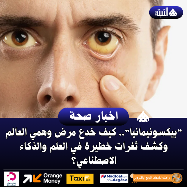 “بيكسونيمانیا”.. كيف خدع مرض وهمي العالم وكشف ثغرات خطيرة في العلم والذكاء الاصطناعي؟