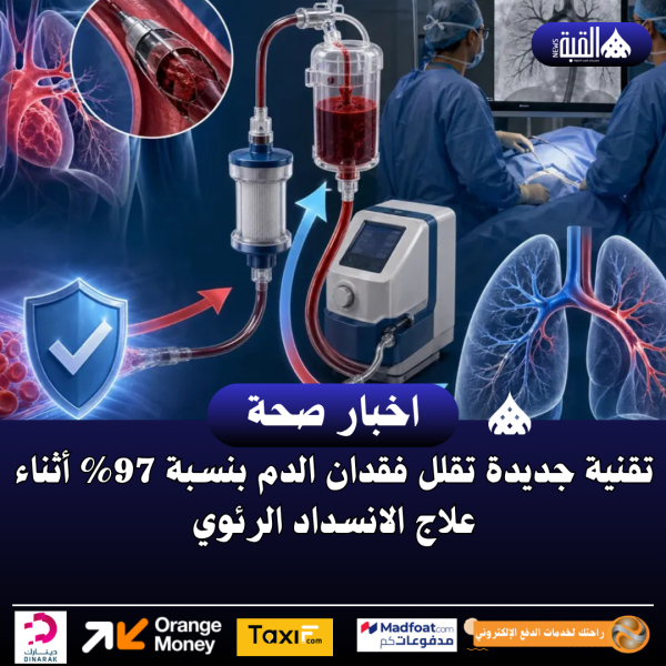 تقنية جديدة تقلل فقدان الدم بنسبة 97 أثناء علاج الانسداد الرئوي
