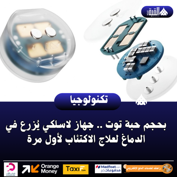 بحجم حبة توت .. جهاز لاسلكي يُزرع في الدماغ لعلاج الاكتئاب لأول مرة