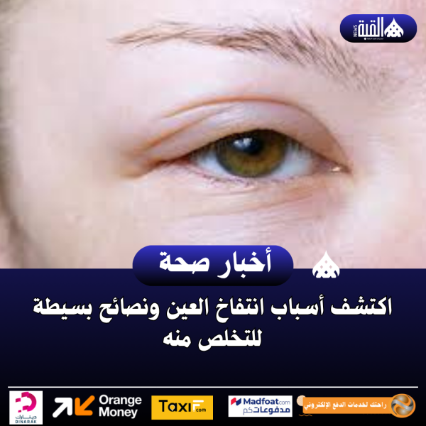 اكتشف أسباب انتفاخ العين ونصائح بسيطة للتخلص منه