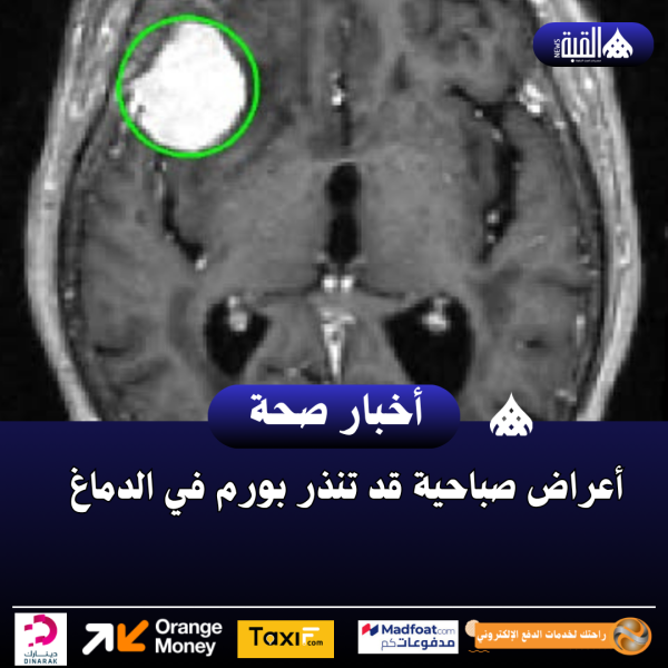 أعراض صباحية قد تنذر بورم في الدماغ