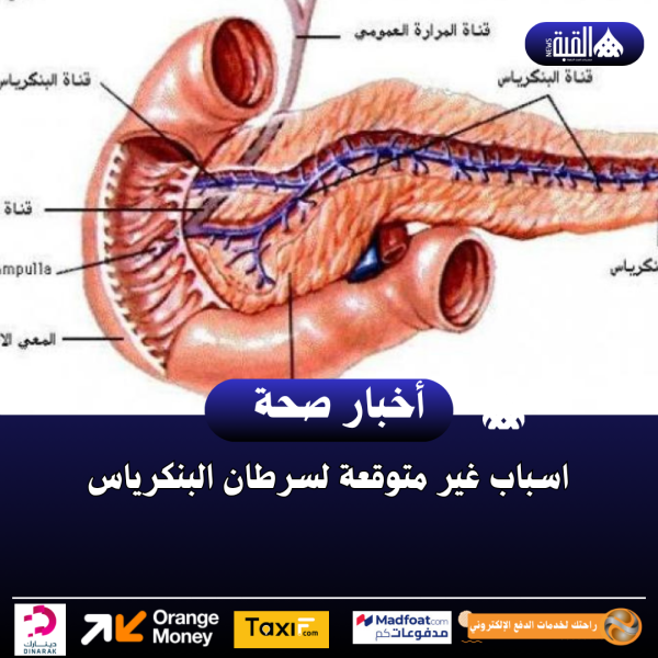 اسباب غير متوقعة لسرطان البنكرياس