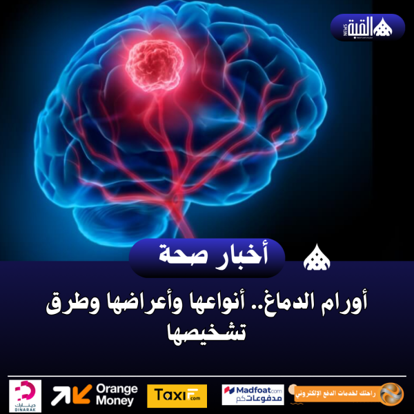 أورام الدماغ.. أنواعها وأعراضها وطرق تشخيصها