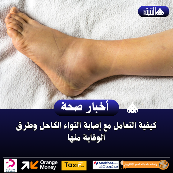 كيفية التعامل مع إصابة التواء الكاحل وطرق الوقاية منها