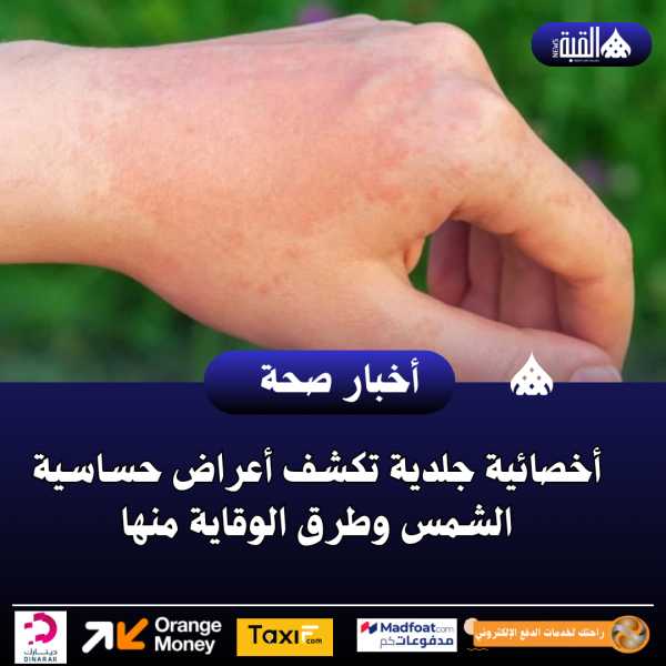 أخصائية جلدية تكشف أعراض حساسية الشمس وطرق الوقاية منها
