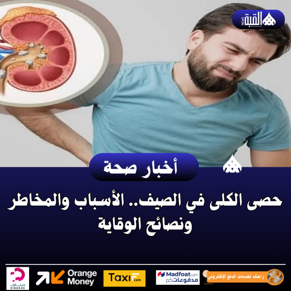 حصى الكلى في الصيف.. الأسباب والمخاطر ونصائح الوقاية
