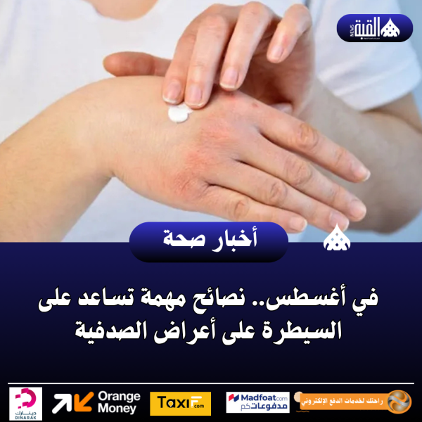 في أغسطس.. نصائح مهمة تساعد على السيطرة على أعراض الصدفية