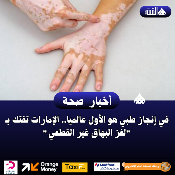 في إنجاز طبي هو الأول عالميا.. الإمارات تفتك بـ لغز البهاق غير القطعي