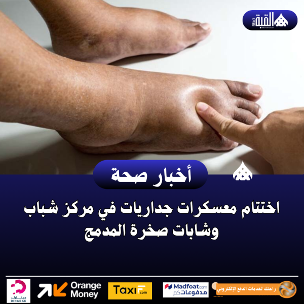 تورم الأطراف السفلية.. الأسباب وطرق العلاج